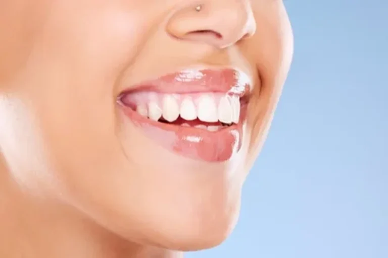 Whitening